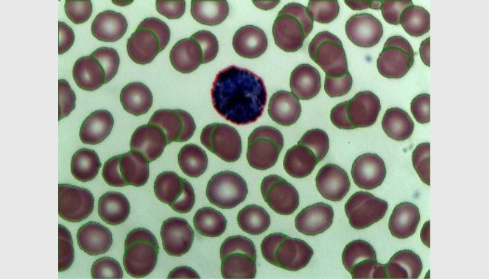 HiCC-Z組合型Ai智能全自動菌落計數、抑菌圈測量、β-內酰胺酶檢測、顯微分析儀