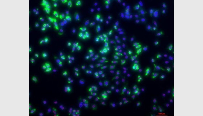 MIA-V生物顯微圖像分析儀系統,細胞計數分析儀